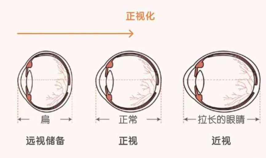 远视储备